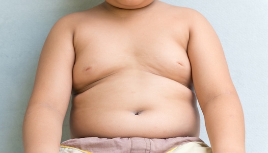 41 million children under age of 5 globally face obesity