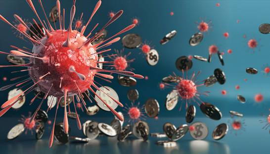 Alvarez & Marsal urges firms to address executive compensation 